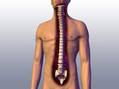 中央型腰椎间盘突出男性可出现特殊症状 中央型腰椎间盘突出男性可出现特殊症状